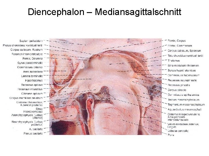 Diencephalon – Mediansagittalschnitt 