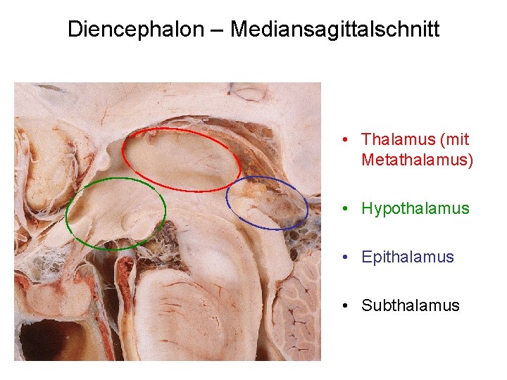 Diencephalon – Mediansagittalschnitt • Thalamus (mit Metathalamus) • Hypothalamus • Epithalamus • Subthalamus 