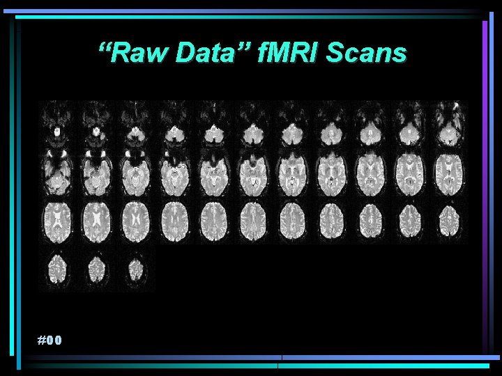 “Raw Data” f. MRI Scans #00 