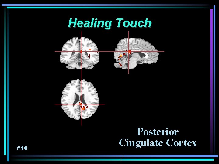 Healing Touch #10 Posterior Cingulate Cortex 