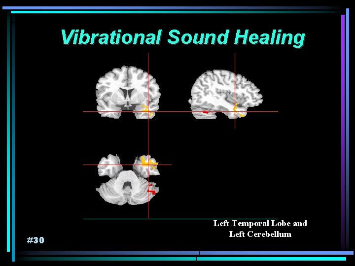 Vibrational Sound Healing #30 Left Temporal Lobe and Left Cerebellum 