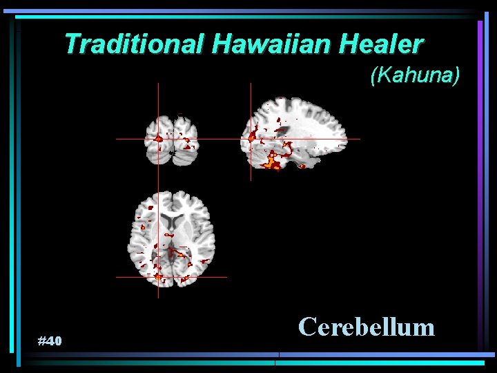 Traditional Hawaiian Healer (Kahuna) Kahuna #40 Cerebellum 