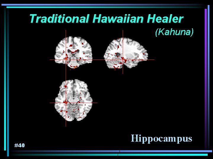 Traditional Hawaiian Healer (Kahuna) Kahuna #40 Hippocampus 