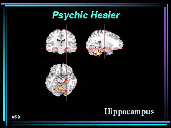 Psychic Healer #50 Hippocampus 