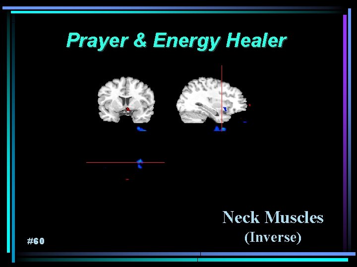 Prayer & Energy Healer Neck Muscles #60 (Inverse) 