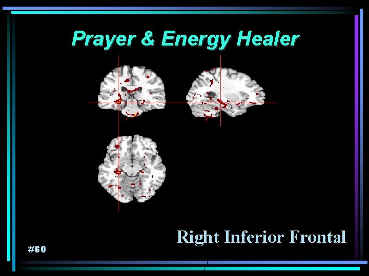 Prayer & Energy Healer #60 Right Inferior Frontal 