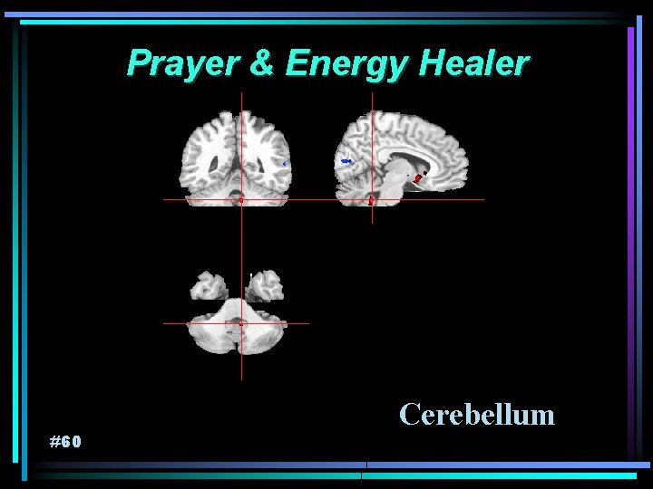 Prayer & Energy Healer #60 Cerebellum 