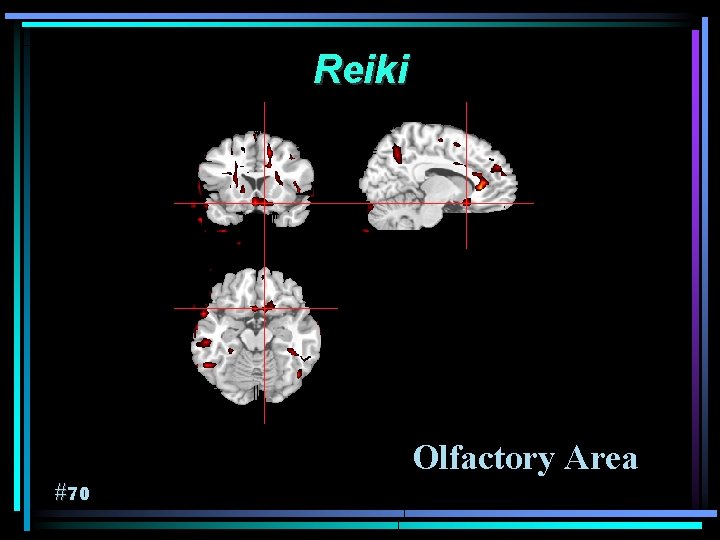 Reiki Olfactory Area #70 