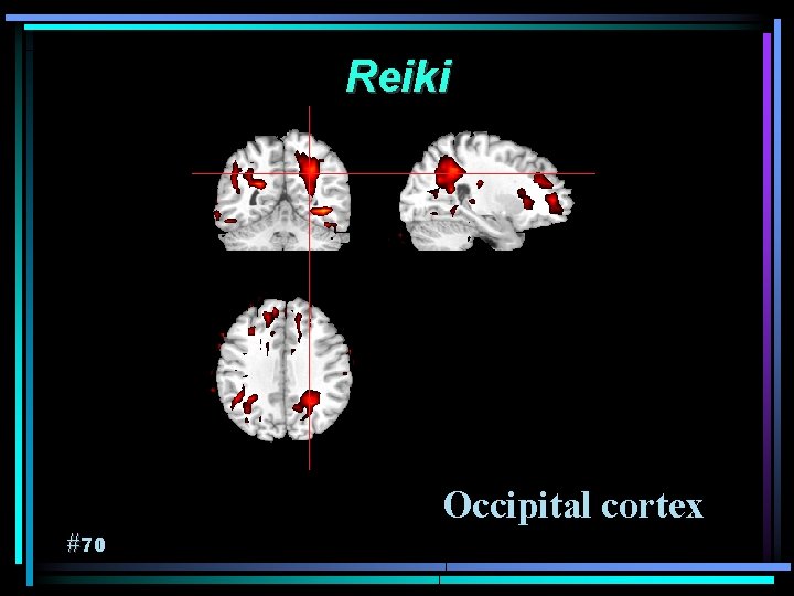 Reiki Occipital cortex #70 