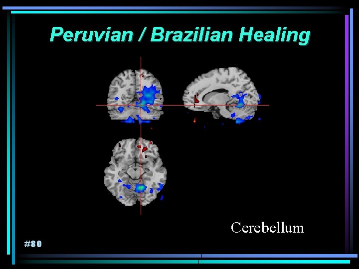 Peruvian / Brazilian Healing Cerebellum #80 