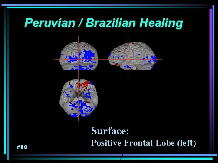 Peruvian / Brazilian Healing Surface: #80 Positive Frontal Lobe (left) 