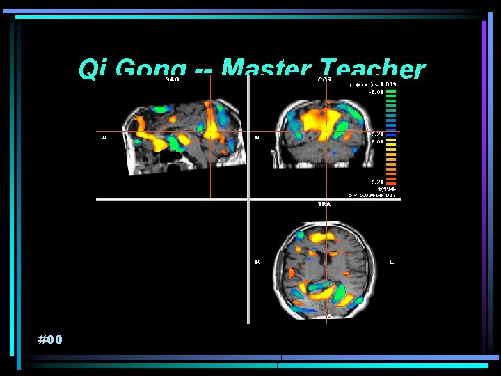 Qi Gong -- Master Teacher #00 