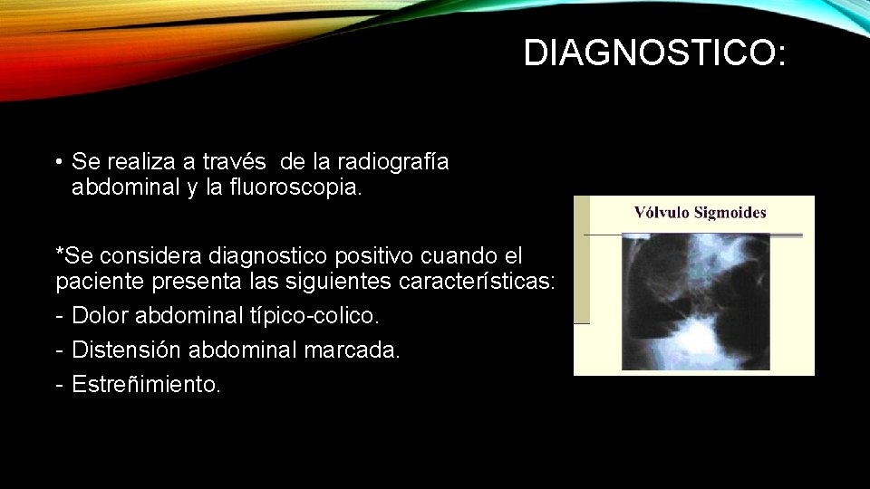 DIAGNOSTICO: • Se realiza a través de la radiografía abdominal y la fluoroscopia. *Se