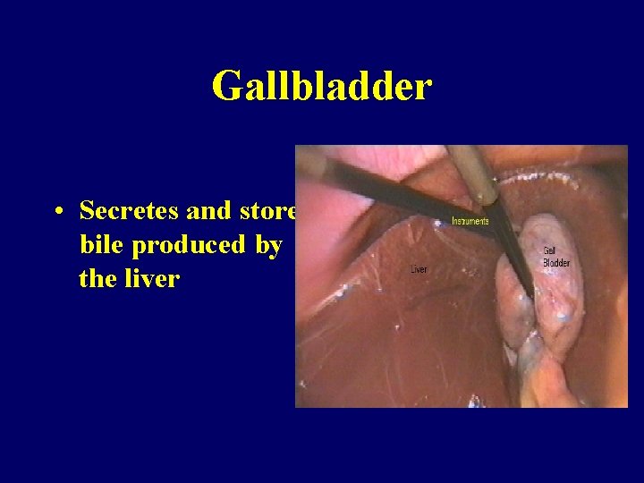 Gallbladder • Secretes and stores bile produced by the liver 