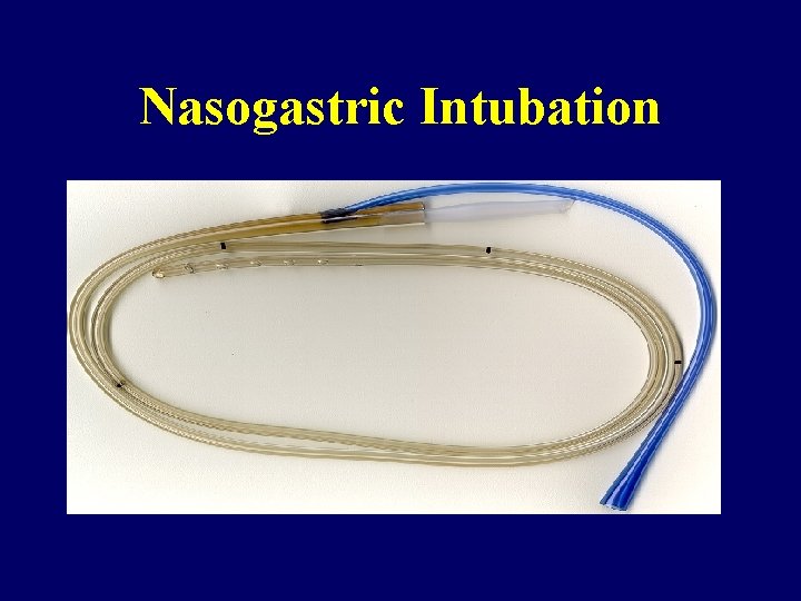 Nasogastric Intubation 