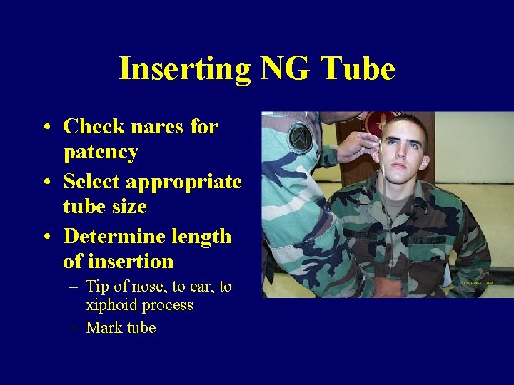 Inserting NG Tube • Check nares for patency • Select appropriate tube size •
