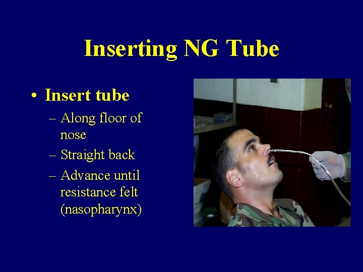 Inserting NG Tube • Insert tube – Along floor of nose – Straight back