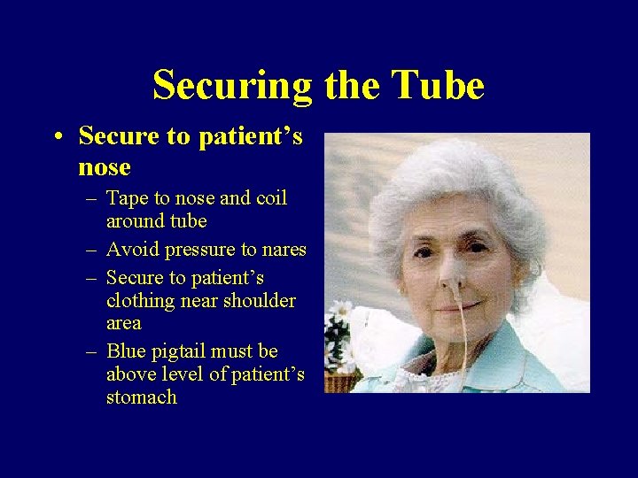 Securing the Tube • Secure to patient’s nose – Tape to nose and coil