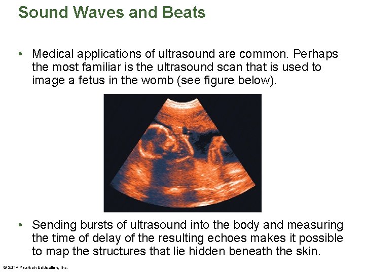 Sound Waves and Beats • Medical applications of ultrasound are common. Perhaps the most