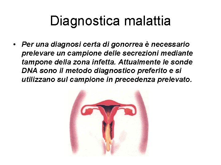 Diagnostica malattia • Per una diagnosi certa di gonorrea è necessario prelevare un campione