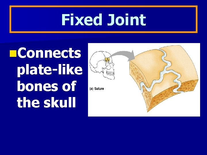Fixed Joint n. Connects plate-like bones of the skull 