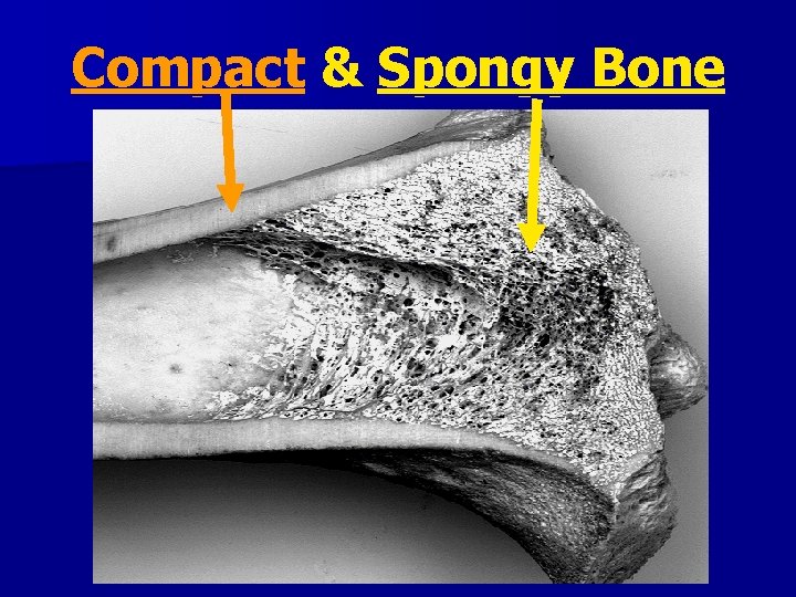 Compact & Spongy Bone 