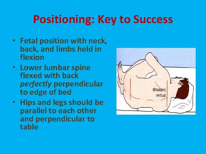Positioning: Key to Success • Fetal position with neck, back, and limbs held in