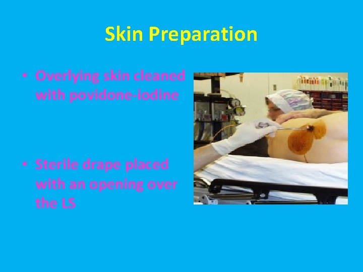 Skin Preparation • Overlying skin cleaned with povidone-iodine • Sterile drape placed with an