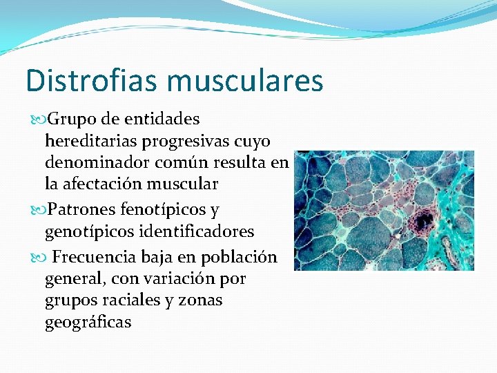 Distrofias musculares Grupo de entidades hereditarias progresivas cuyo denominador común resulta en la afectación