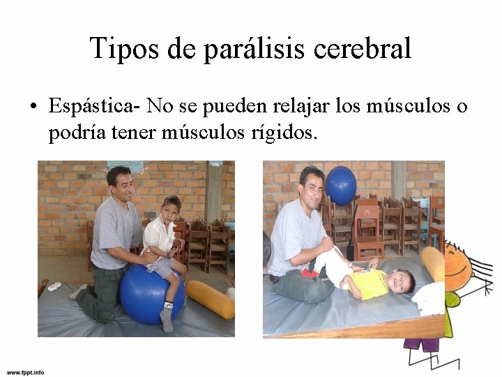 Tipos de parálisis cerebral • Espástica- No se pueden relajar los músculos o podría