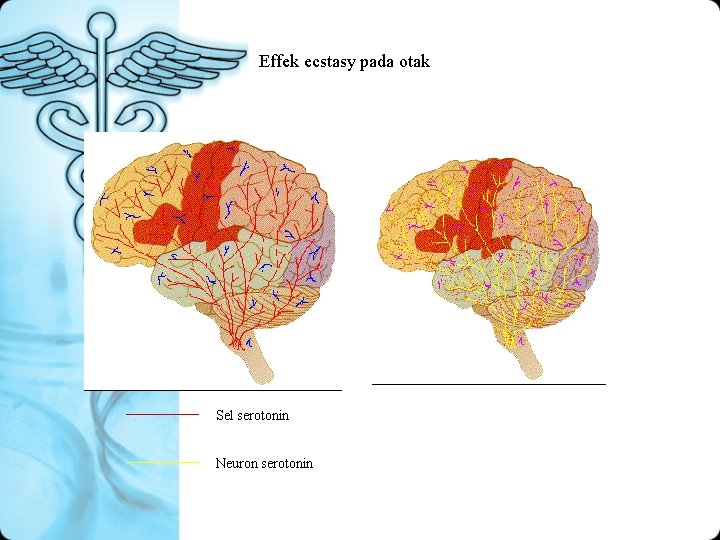 Effek ecstasy pada otak Sel serotonin Neuron serotonin 