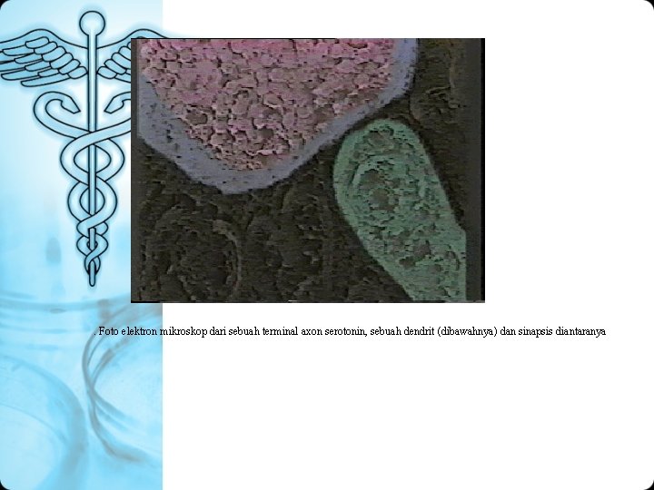 . Foto elektron mikroskop dari sebuah terminal axon serotonin, sebuah dendrit (dibawahnya) dan sinapsis