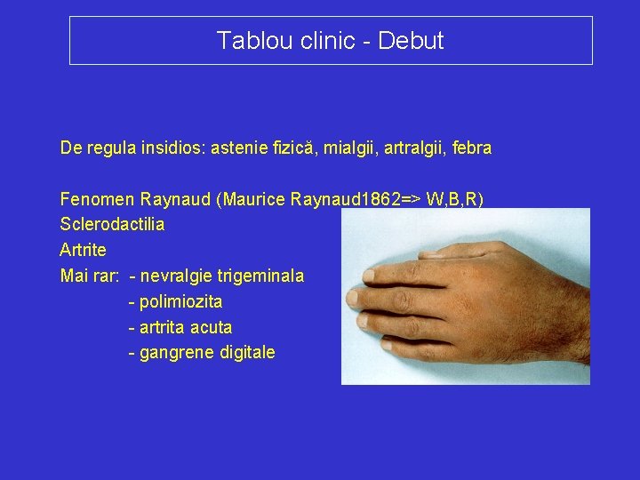 Tablou clinic - Debut De regula insidios: astenie fizică, mialgii, artralgii, febra Fenomen Raynaud