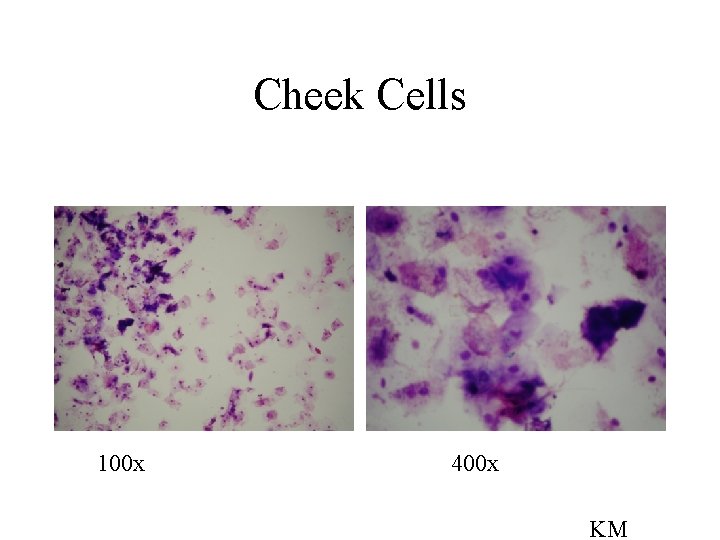 Cheek Cells 100 x 400 x KM 