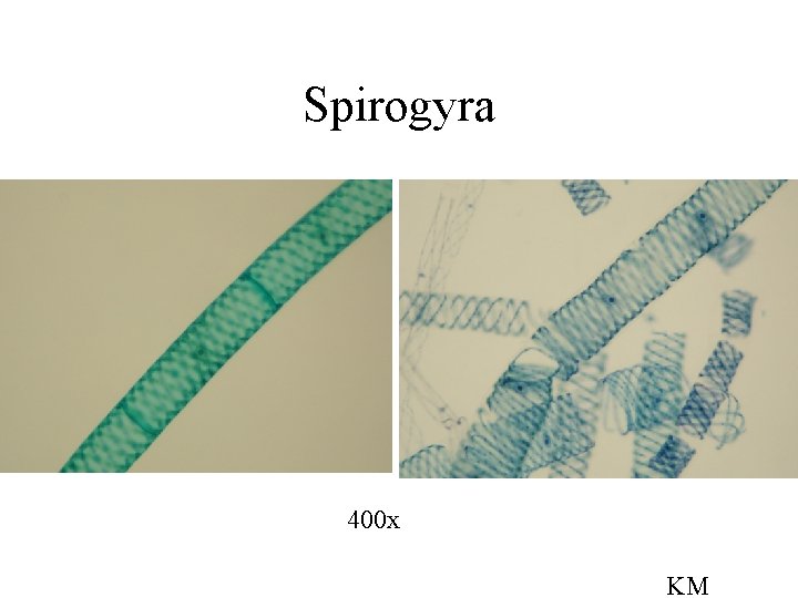 Spirogyra 400 x KM 