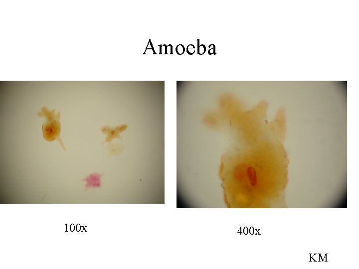 Amoeba 100 x 400 x KM 