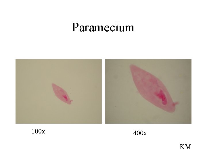 Paramecium 100 x 400 x KM 