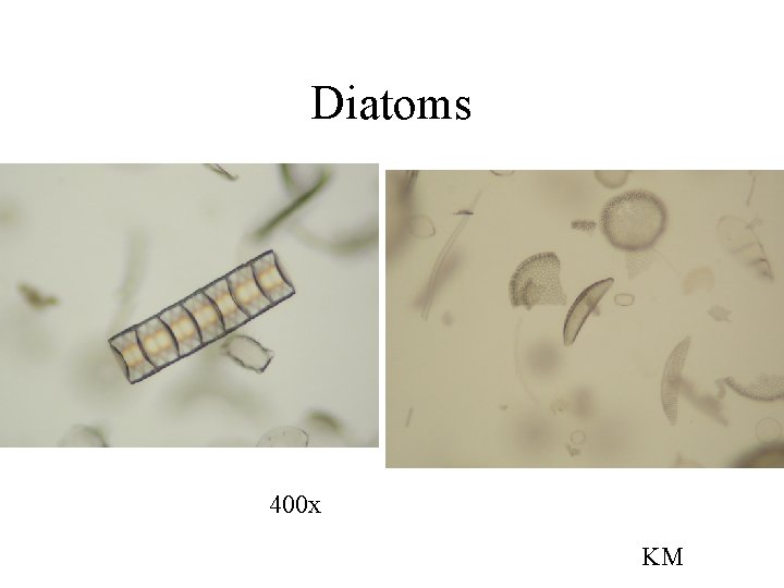 Diatoms 400 x KM 