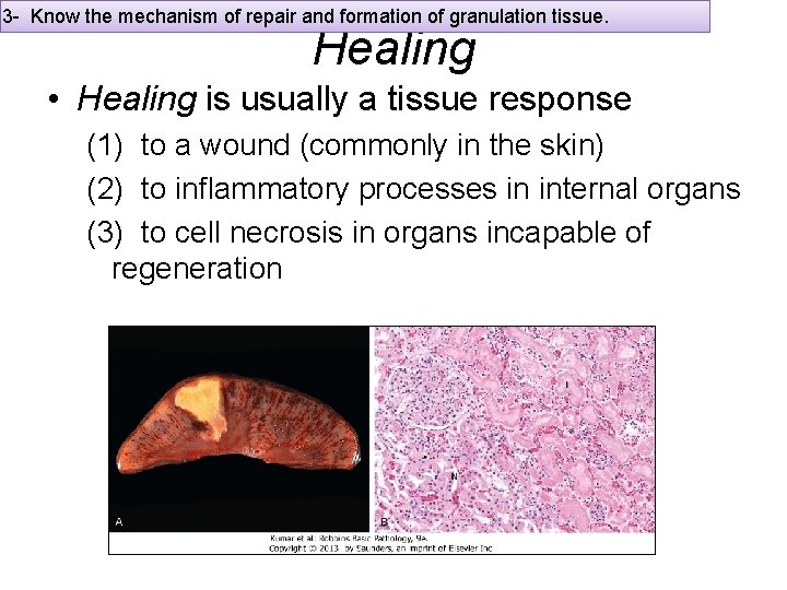 3 - Know the mechanism of repair and formation of granulation tissue. Healing •