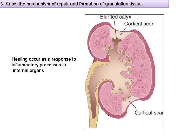 3. Know the mechanism of repair and formation of granulation tissue. Healing occur as