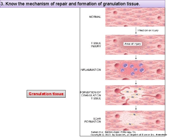 3. Know the mechanism of repair and formation of granulation tissue. Granulation tissue ©