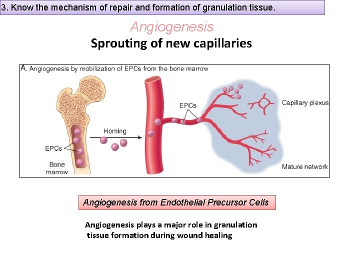 3. Know the mechanism of repair and formation of granulation tissue. Angiogenesis Sprouting of