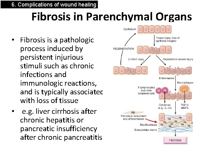 6. Complications of wound healing Fibrosis in Parenchymal Organs • Fibrosis is a pathologic