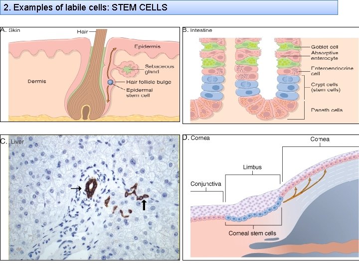 2. Examples of labile cells: STEM CELLS 