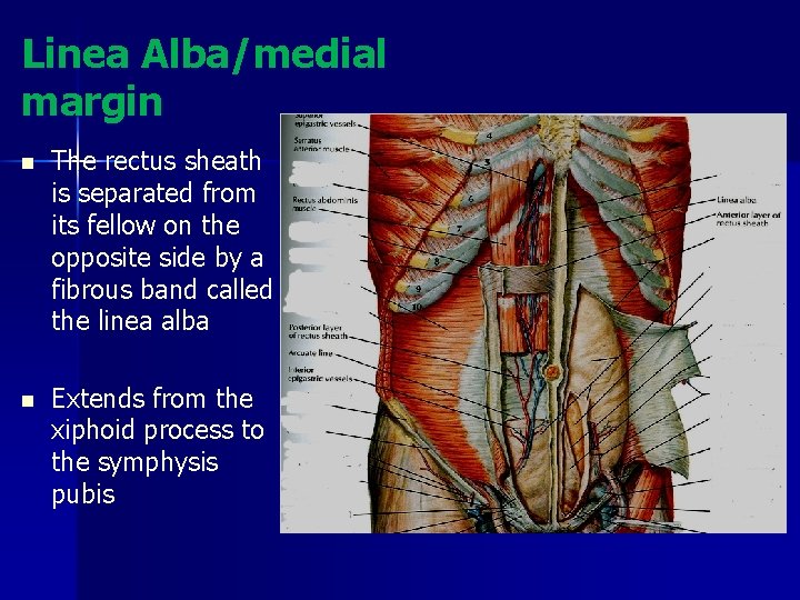 Linea Alba/medial margin n The rectus sheath is separated from its fellow on the