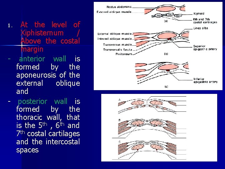 At the level of Xiphisternum / Above the costal margin - anterior wall is