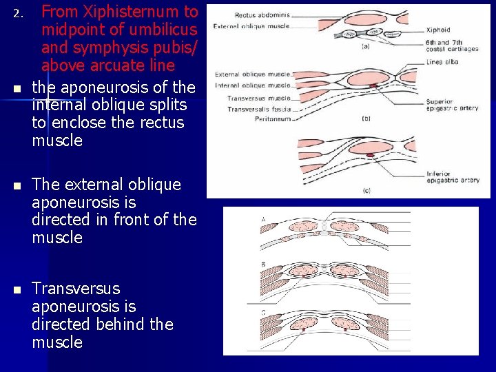 2. n From Xiphisternum to midpoint of umbilicus and symphysis pubis/ above arcuate line