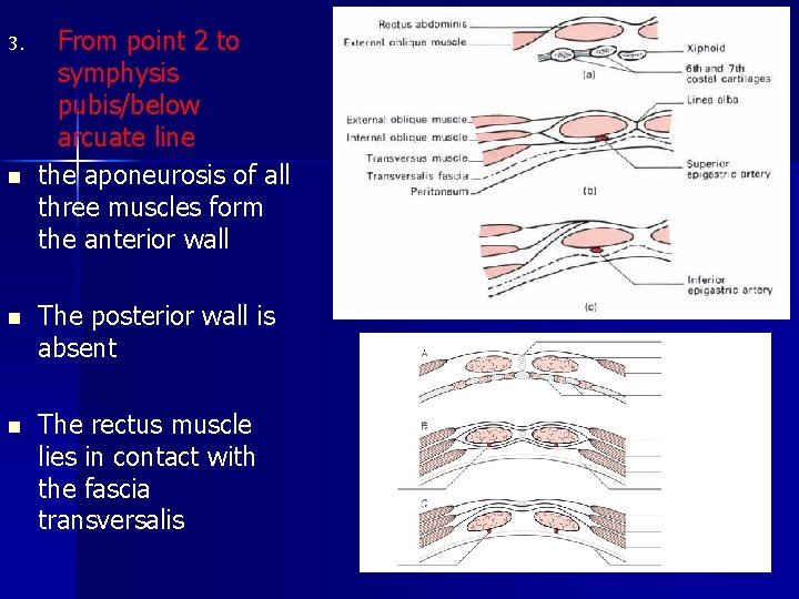 3. n From point 2 to symphysis pubis/below arcuate line the aponeurosis of all