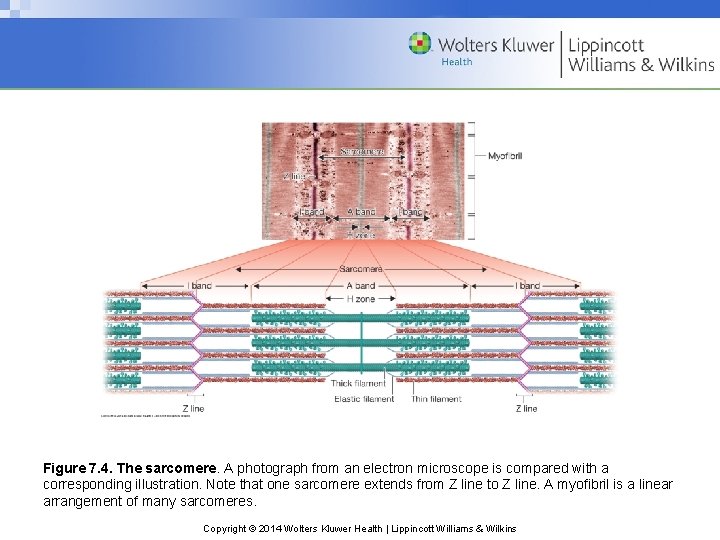 Figure 7. 4. The sarcomere. A photograph from an electron microscope is compared with