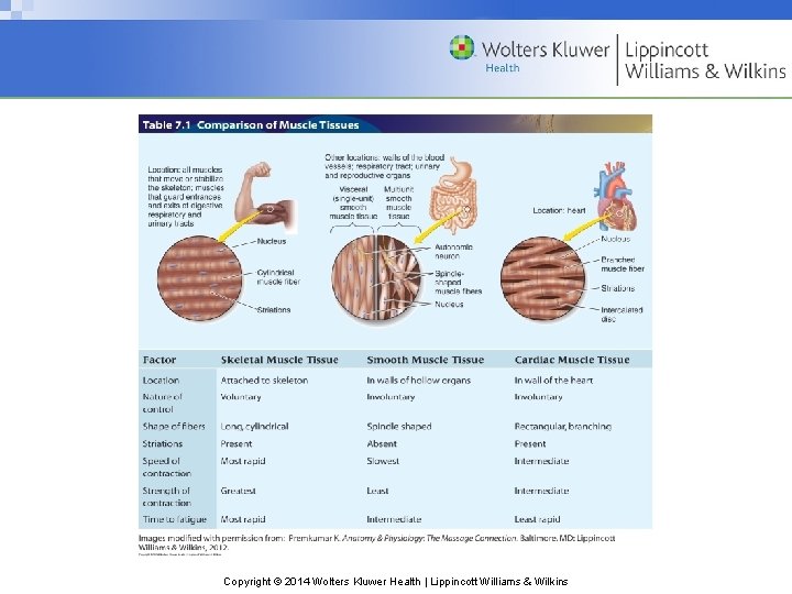 Copyright © 2014 Wolters Kluwer Health | Lippincott Williams & Wilkins 